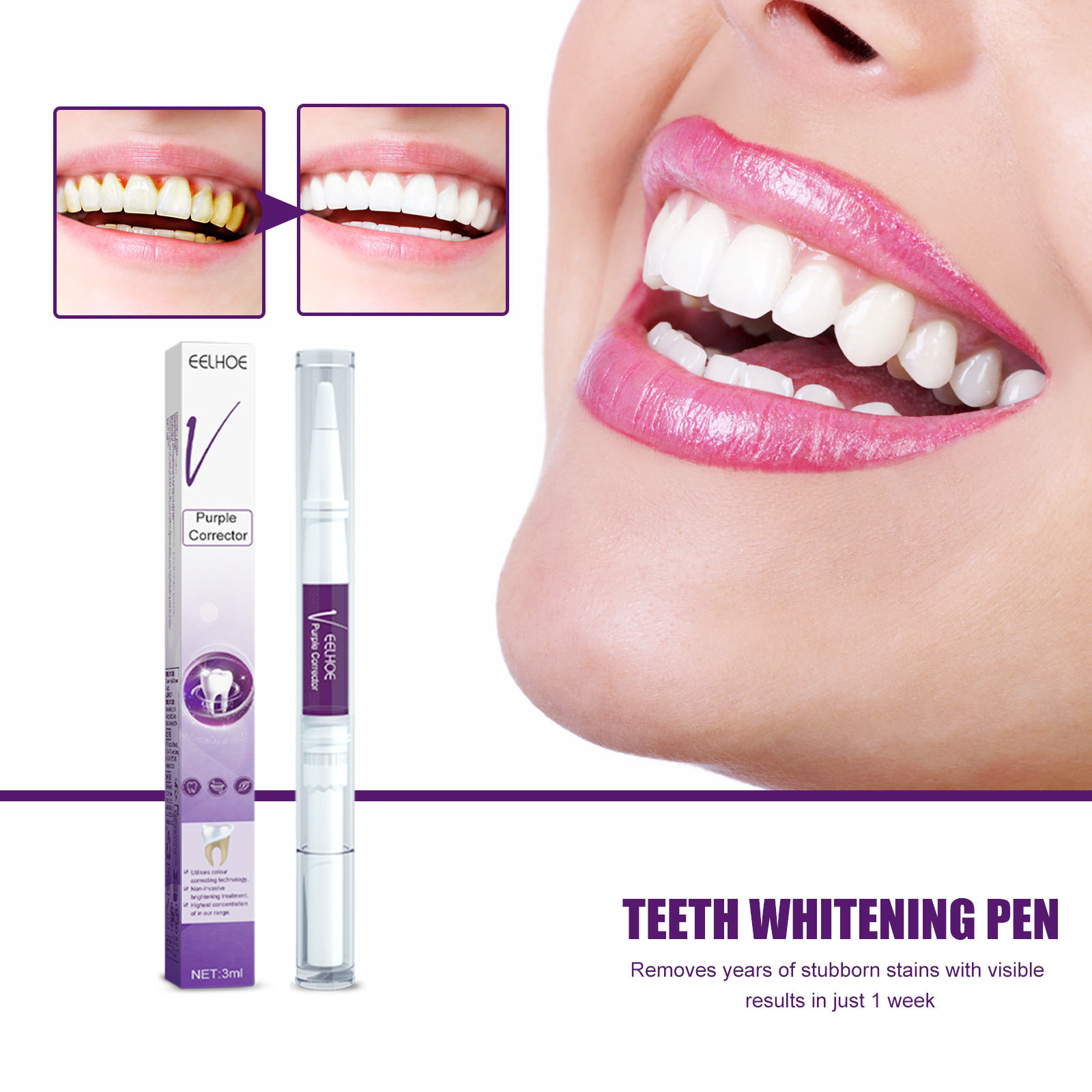 Whitening Pen Bleach - Stylo dentifrice violet pour blanchir les