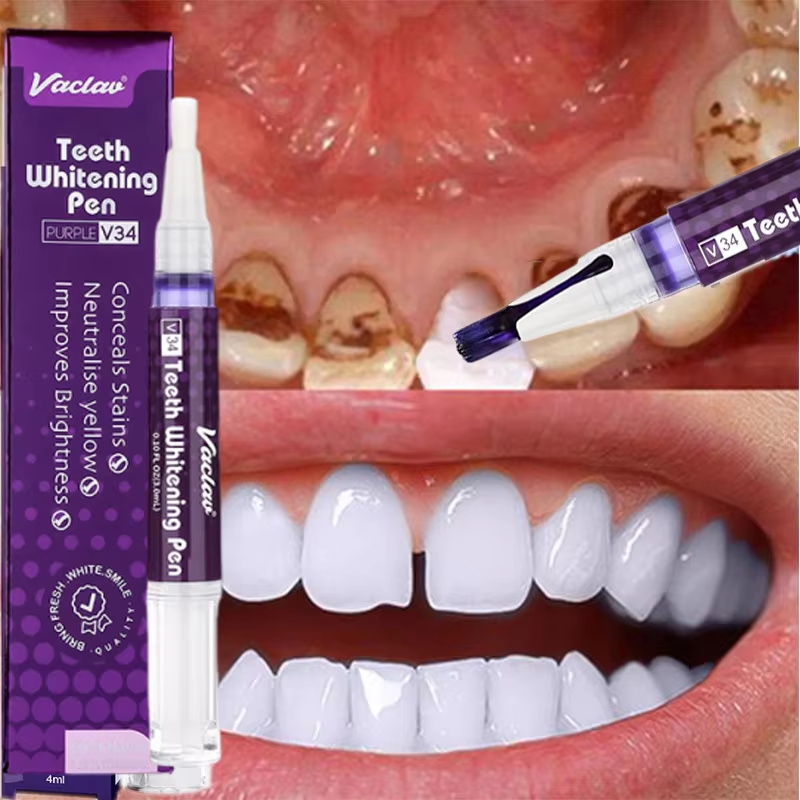Whitening Pen Bleach - Stylo Blanchissant V34 pour les Dents,