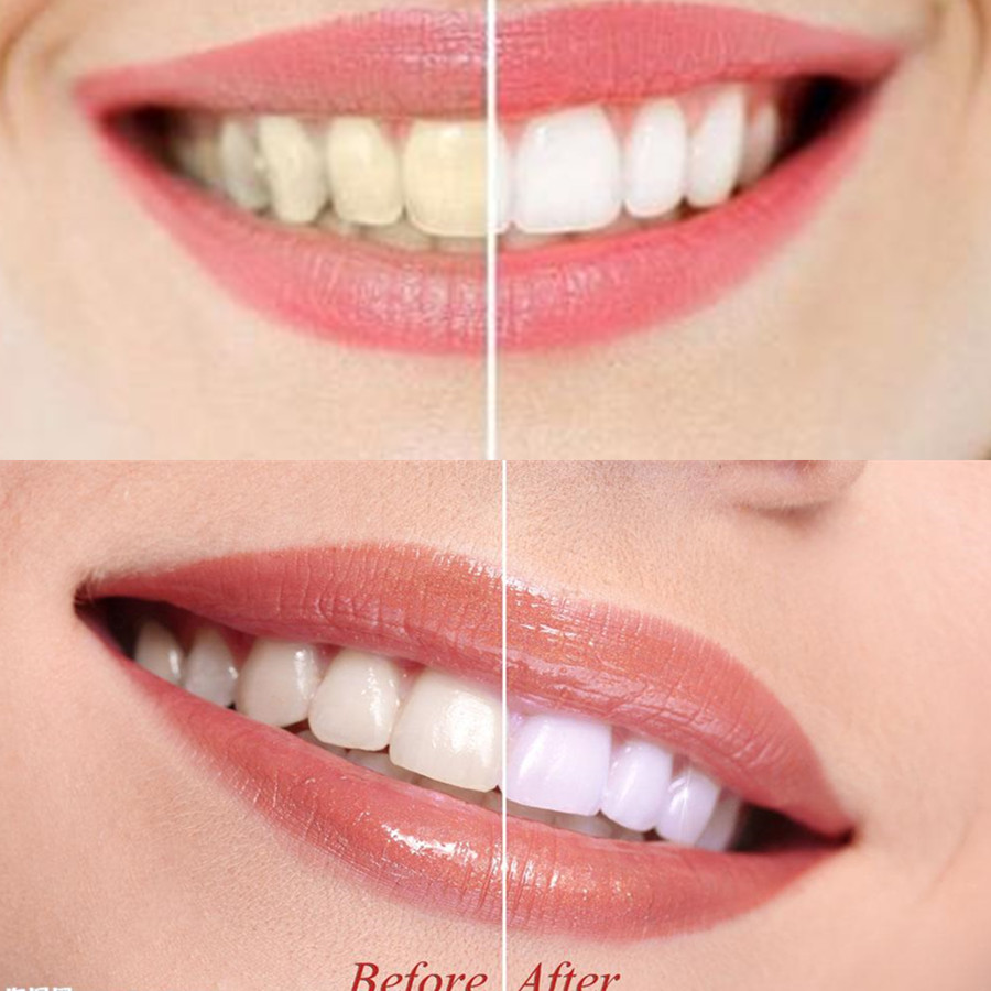 Poudre de charbon de bambou po - Teeth Whitening Charcoal Powder avis et prix