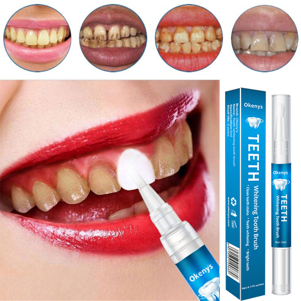 Kit de Blanchiment des Dents a - Whitening Pen Bleach avis et prix