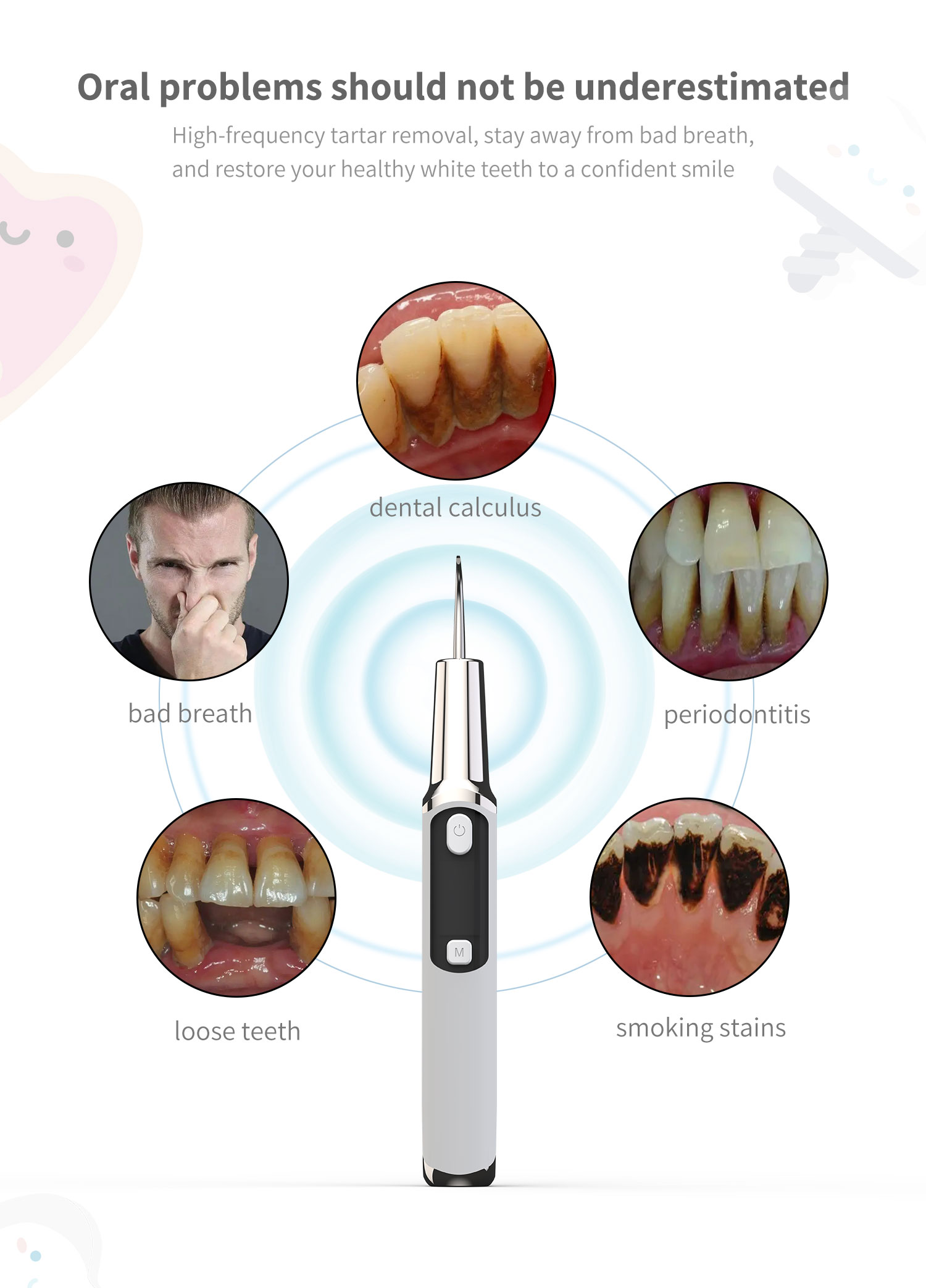 Détartreur de calcul dentaire  - Teeth Whitening Or Tooth Whitening avis et prix