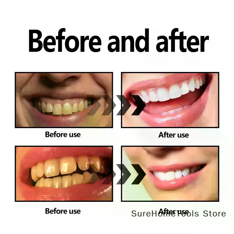 Poudre de charbon de bambou po - Teeth Whitening Charcoal Powder avis et prix