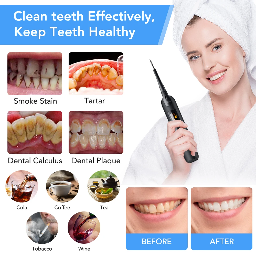 Détartreur dentaire électrique - Teeth Whitening Or Tooth Whitening avis et prix