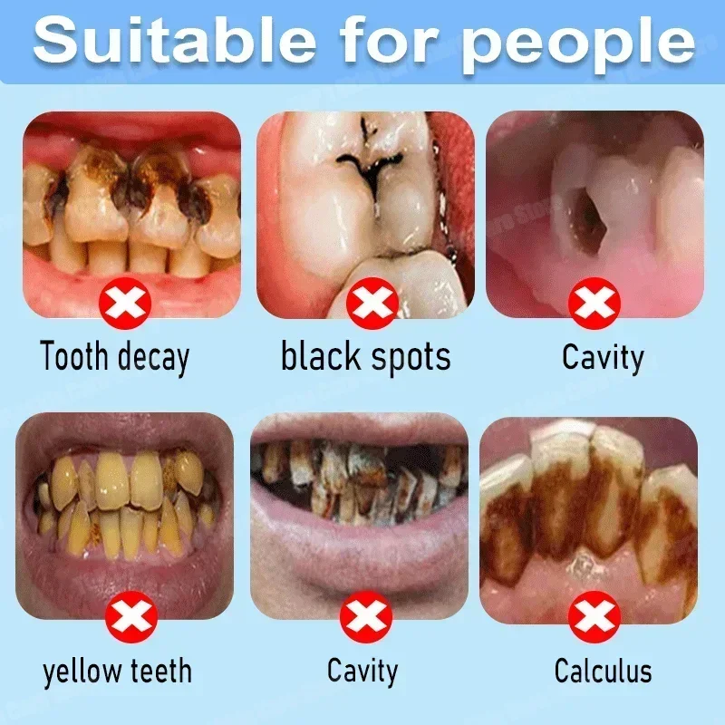 Dentifrice anti-caries : répar - Teeth Whitening Charcoal Powder avis et prix