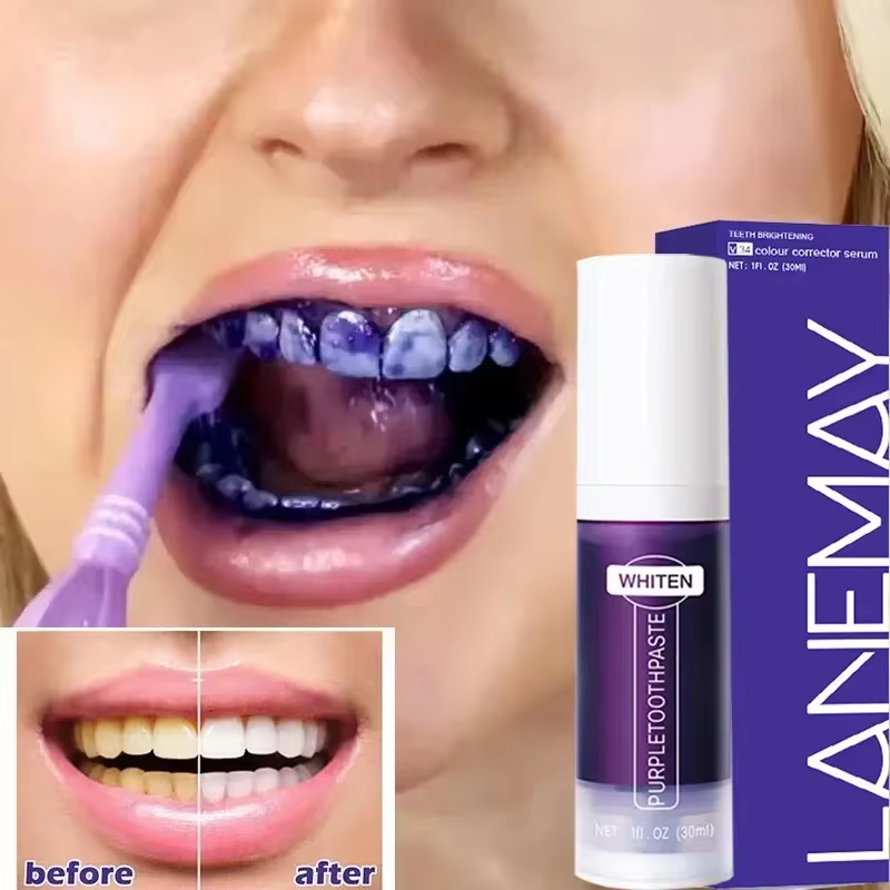 V34 violet blanchiment des den - Teeth Whitening Charcoal Powder avis et prix
