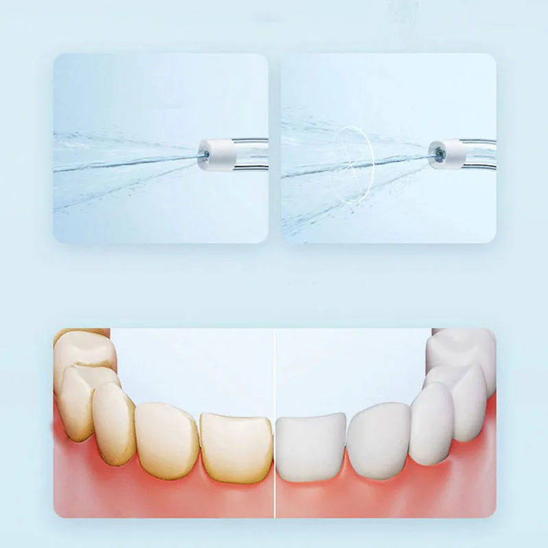 Xiaomi Irrigateur buccal porta - Teeth Whitening Or Tooth Whitening avis et prix