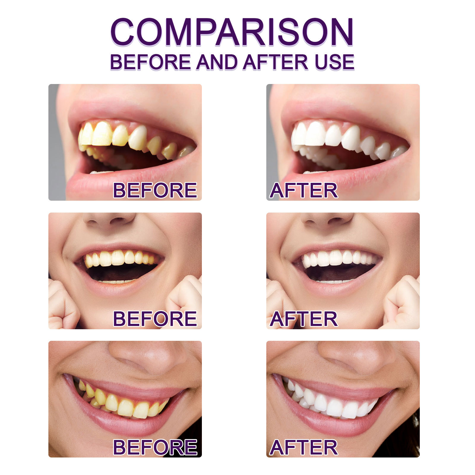 Stylo dentifrice violet pour b - Whitening Pen Bleach avis et prix