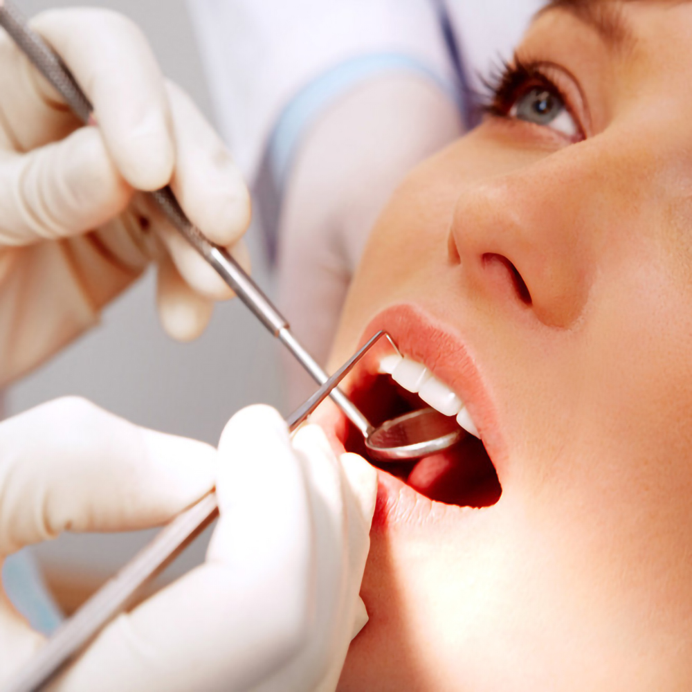 Pincettes dentaires en acier i - Teeth Whitening Products avis et prix