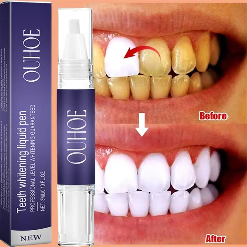 Stylo dentifrice à blanchiment - Whitening Pen Bleach avis et prix