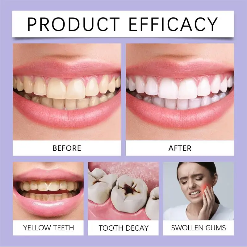 Stylo dentifrice à blanchiment - Whitening Pen Bleach avis et prix