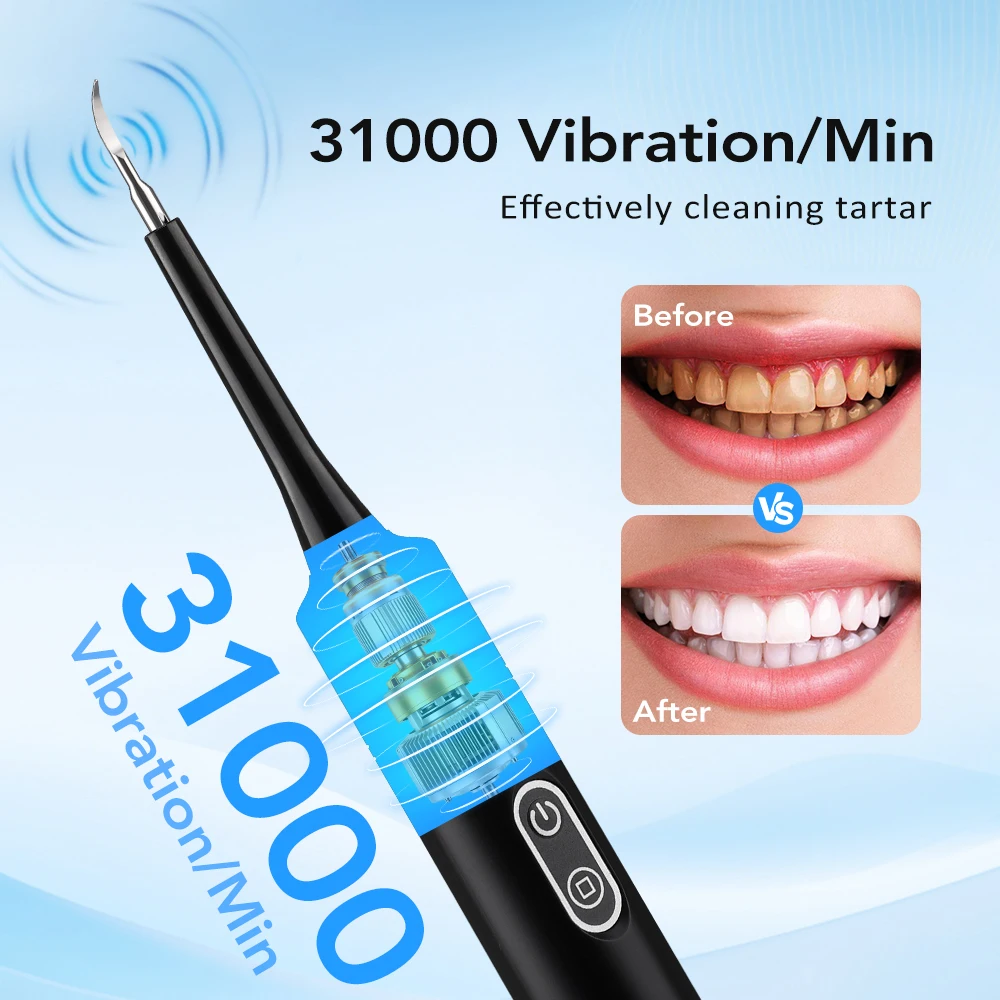 Détartreur dentaire électrique - Teeth Whitening Products avis et prix